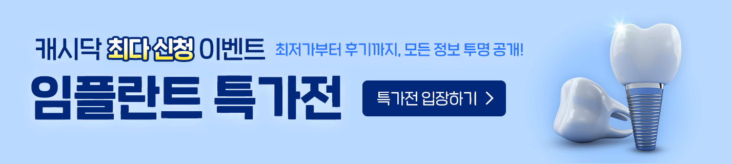 임플란트 특가전